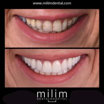 Slider image (10) Milim Dental